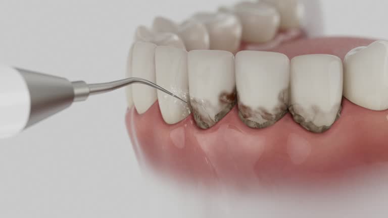 Reliable Dental Implants contractor in Rainbow City, AL by Smile Center Dentistry